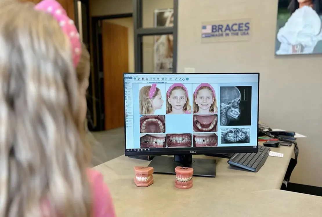 Orthodontic consultation monitor displaying a child's treatment images beside dental models.